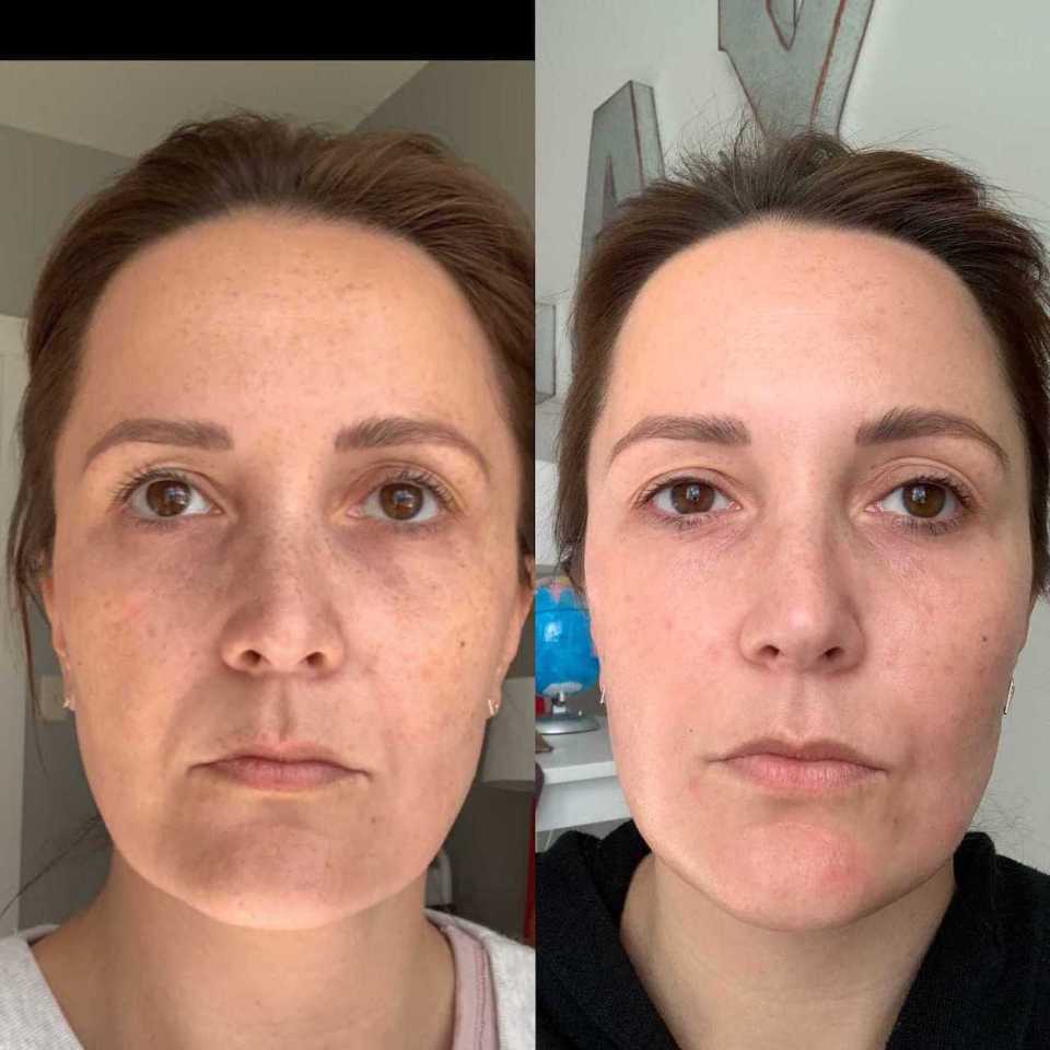 Transform Your Aging Skin Naturally