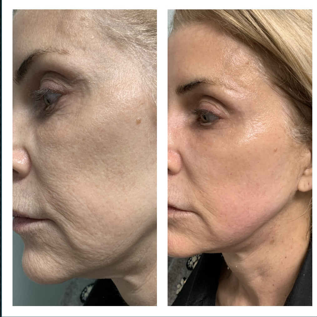 Transform Your Aging Skin Naturally