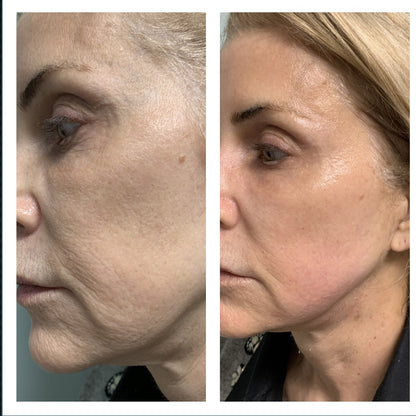Transform Your Aging Skin Naturally