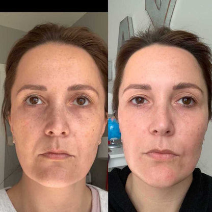 Transform Your Aging Skin Naturally