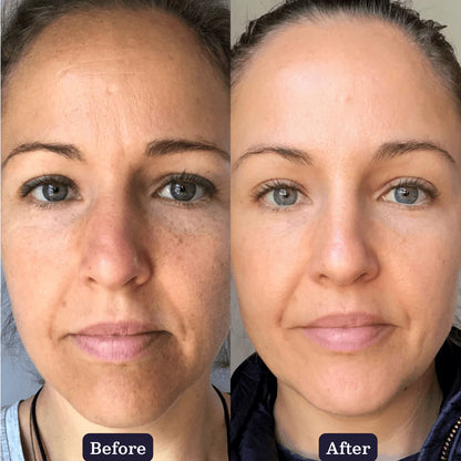 Transform Your Aging Skin Naturally